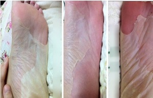 OEM ODM Peeling Feet Mask Exfoliating Socks Baby Care Pedicure Socks Remove Dead Skin Cuticles Suso Socks For Man Woman