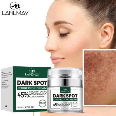 Pimples Melasma Blemish Removal Dark Spot Remover Cream Strong Bleaching Whitening Face Freckles Remove Corrector Cream