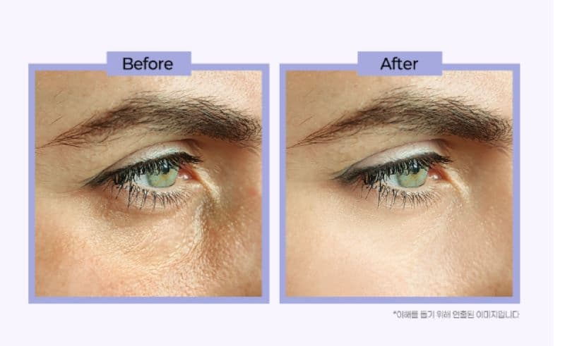 Retinol eye cream