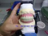 Dental lab outsourcing - dental lab exporting China Professional Dental Lab