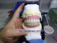 Dental lab outsourcing - dental lab exporting China Professional Dental Lab