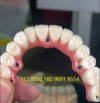 Dental lab outsourcing - dental lab exporting China Professional Dental Lab
