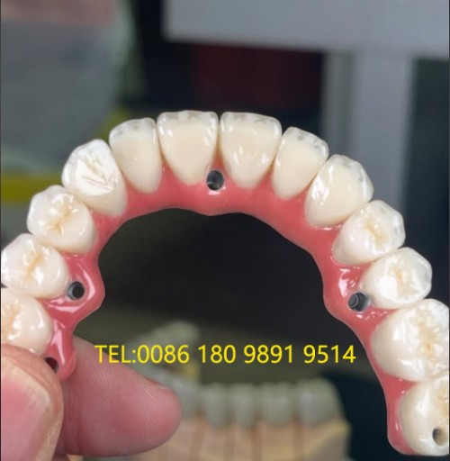 Dental lab outsourcing - dental lab exporting China Professional Dental Lab