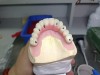 Dental lab outsourcing - dental lab exporting China Professional Dental Lab