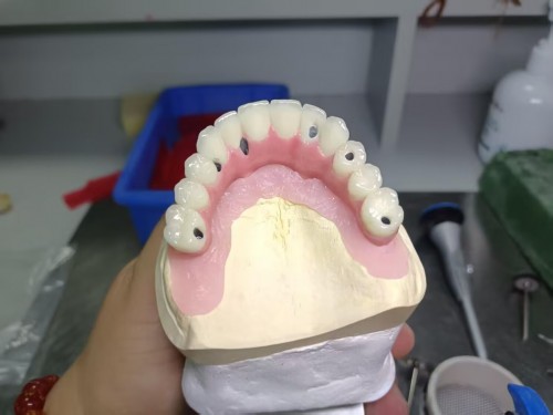 Dental lab outsourcing - dental lab exporting China Professional Dental Lab