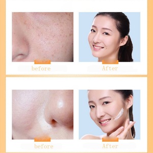 Best Natural Retinol Moisturizer Anti Aging Whitening Skin Tightening Vitamin c Face Cream For Face Skin