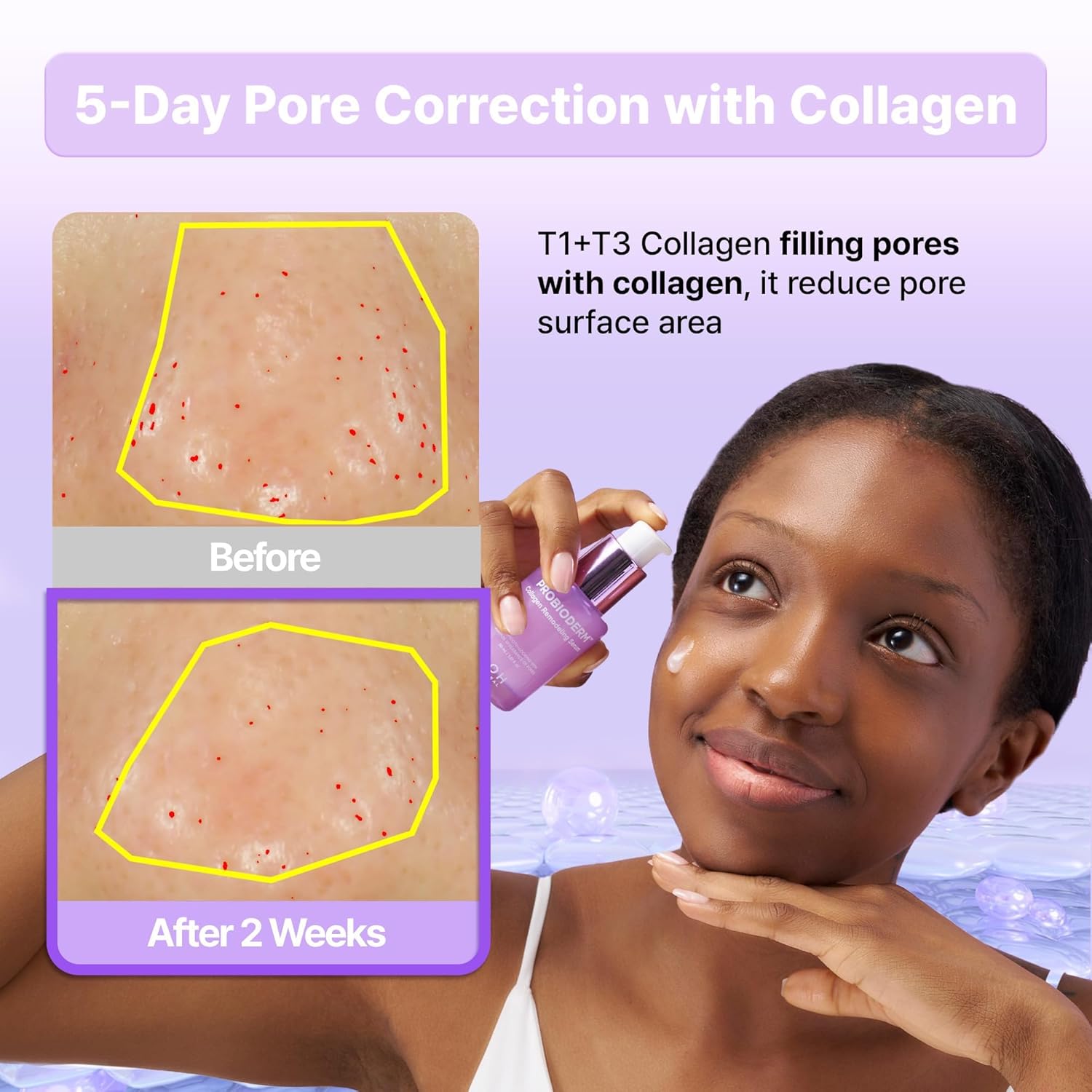 BIOHEAL BOH Probioderm™ Collagen Remodeling Serum 1.01 fl oz (30 ml)  Skin Firming Serum with Colla