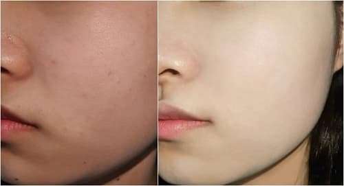 SNOW-BLOSSOM WHITENING CREAM