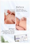 Pregnant and Maternal skin repair dressing assist the treatment of dry skin, red itching, eczema