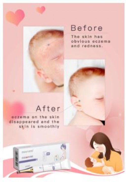 Pregnant and Maternal skin repair dressing  help support the  