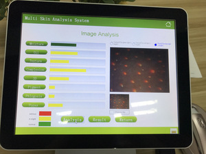 2018 best-selling UV touch screen 3d smart skin analyzer
