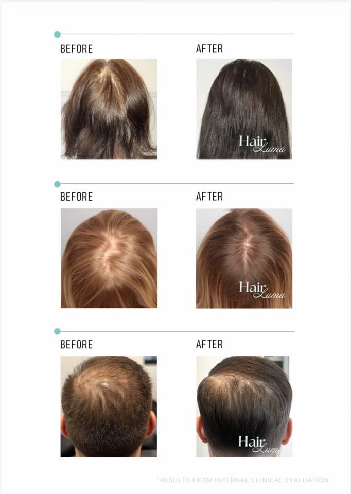 Hair Luma  Scalp, Hair care