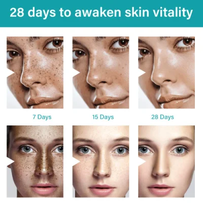 Wholesale Customize Own Brand Strong Whitening Freckle Cream Removal Melasma Dark Spot Melanin Remover Brighten Skin Face Cream