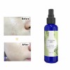 Rosemary Pure Floral Water Shrink Pores Anti Acne Dew