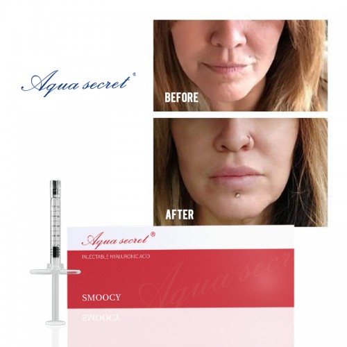 Aqua Secret best price ha injectable hyaluronic acid dermal filler