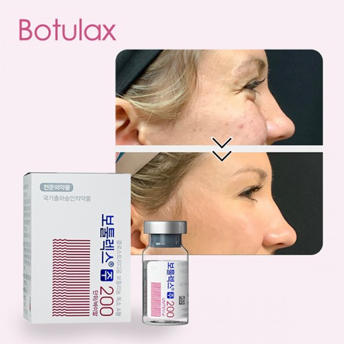 Low Price Wholesale botulax 100u opiniones buy online for Face Firming