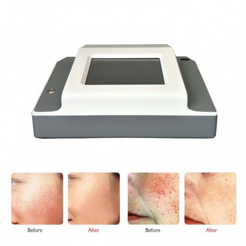 Professional 980nm Diode Laser Vascular Removal Beauty Machine