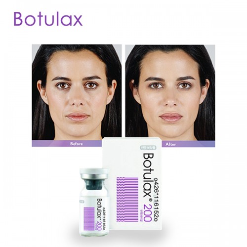 Low Price Wholesale botulax 100u opiniones buy online for Face Firming