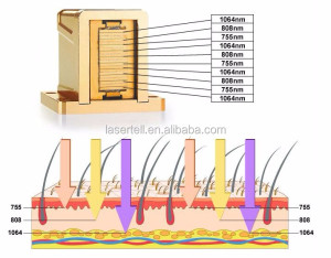 2020 trio laser hair removal triple wavelength (755 808 1064nm) diode laser hair removal machine desktop design new design
