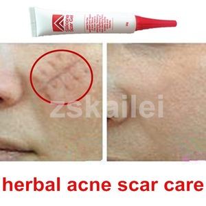 best clinic products scar removal cream 30g