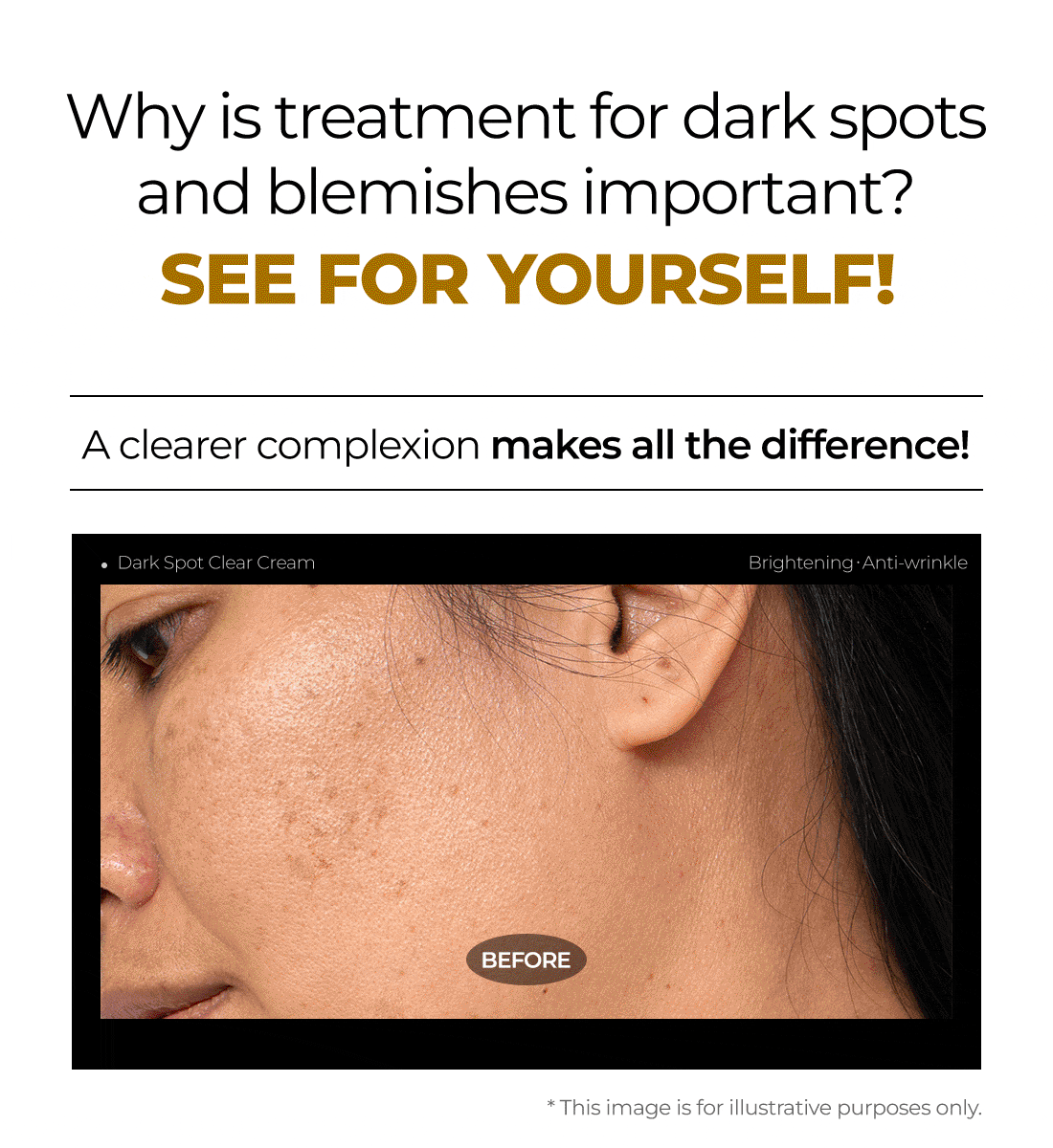 DARK SPOT CLEAR CREAM
