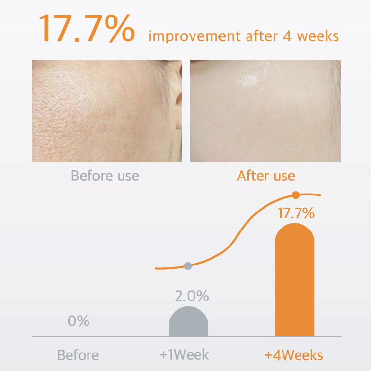 SELASTIN TOX  Anti Wrinkle and Glutathione Whitening Skin Booster