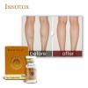 Korean Toxin Injection 50ui Innotox Wrinkle Removal Anti Ageing Botulinum