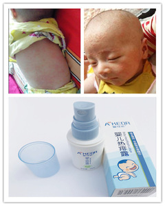 Anti-itching baby skin care use herbal prickly heat powder spray