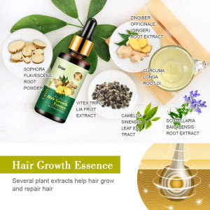 7 Days 30ml Ginger Oil Make Hair Regrowth Nourishment and Thickening Hair Loss Treatment for Damaged Hair