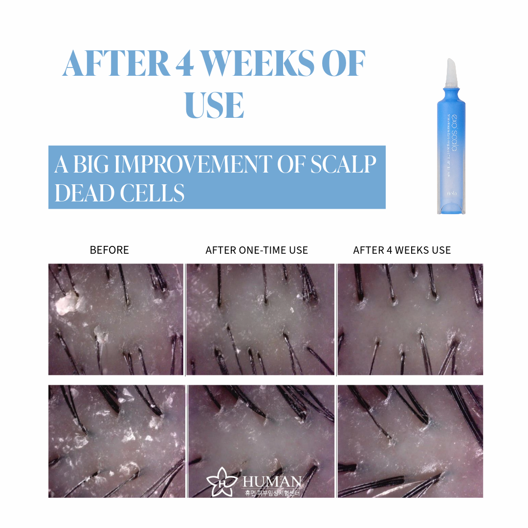Riola Exo Scala Hair Loss Relief