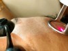 RF CO₂ Fractional Laser for Scar Removal Vaginal Tightening Beauty Equipment