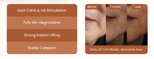 Injectable CaHA Filler Series