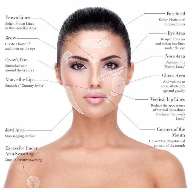 Nabota 100iu 200iu Directly Supply Best Seller For Face Body Frown