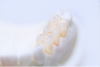 Full Contour Zirconia