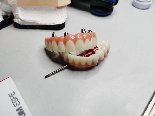 Full Contour Zirconia