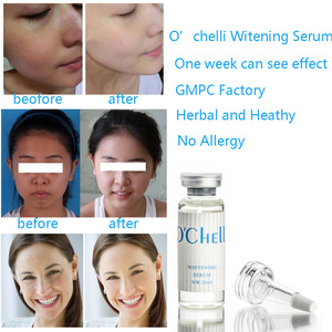 Whitening Anti-aging Collagen Private Label Skin Care Skin whitening serum and lotion