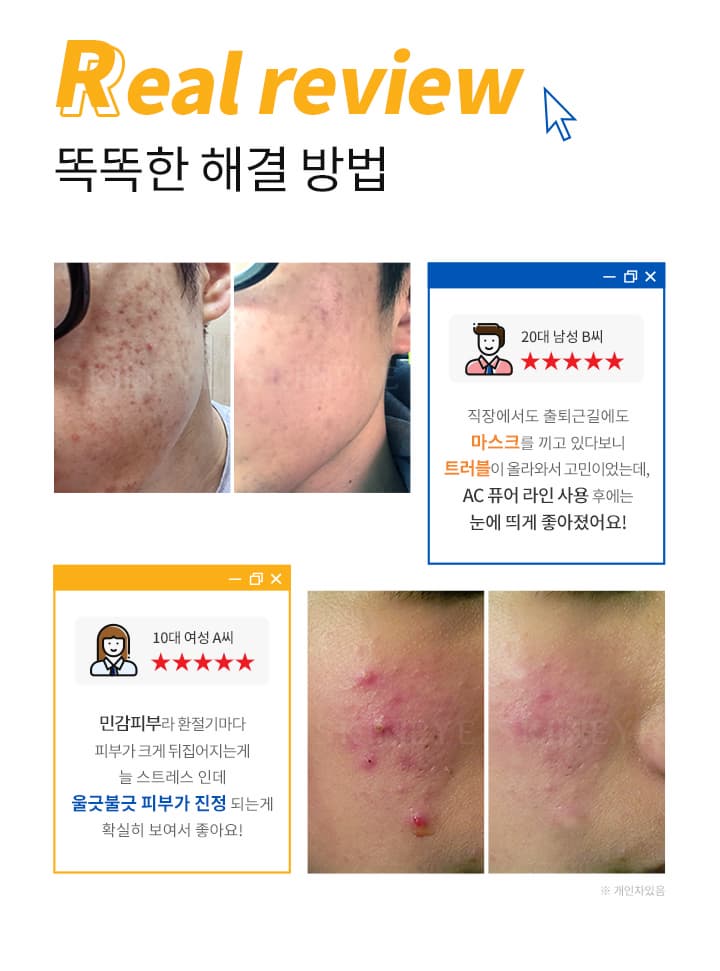 Skineye AC Pure 4 products set