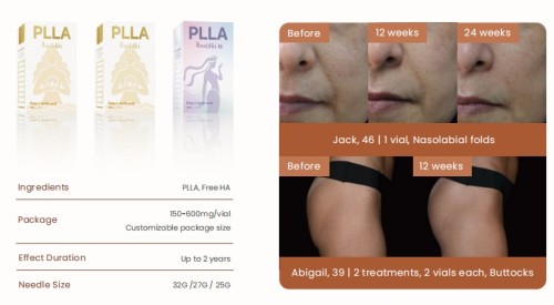 Injectable PLLA Filler Series