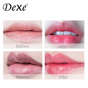  China Supplier Dexe Animal Lip Balm With Factory Price