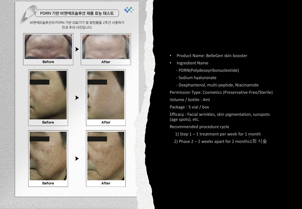 Bellegen Skinbooster