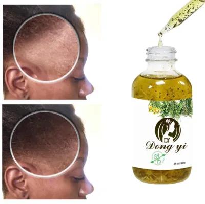 Best Private Label Scalp Treatment Herbal Natural Organic Tea Tree Oil Shampoo with Liquid Keratin Moisturizing Shampoo OEM