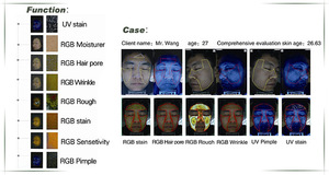 Skin care machine/intelligent skin analyzer/facial skin analysis