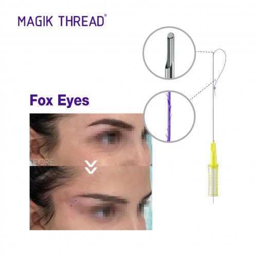 Magik Thread hot selling 21G 60mm cog 4d L pdo fox eye thread lift