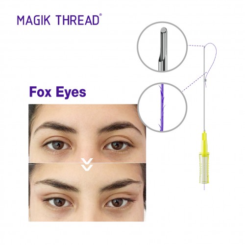 Magik Thread hot selling 21G 60mm cog 4d L pdo fox eye thread lift