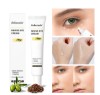 Lakerain Probiotic Peptide Eye Cream, Gentle Hydrating Eye Serum Cream, Revitalize & Nourish Eye Area, Reduce Dryness for All Skin Types