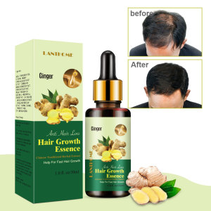 7 Days 30ml Ginger Oil Make Hair Regrowth Nourishment and Thickening Hair Loss Treatment for Damaged Hair