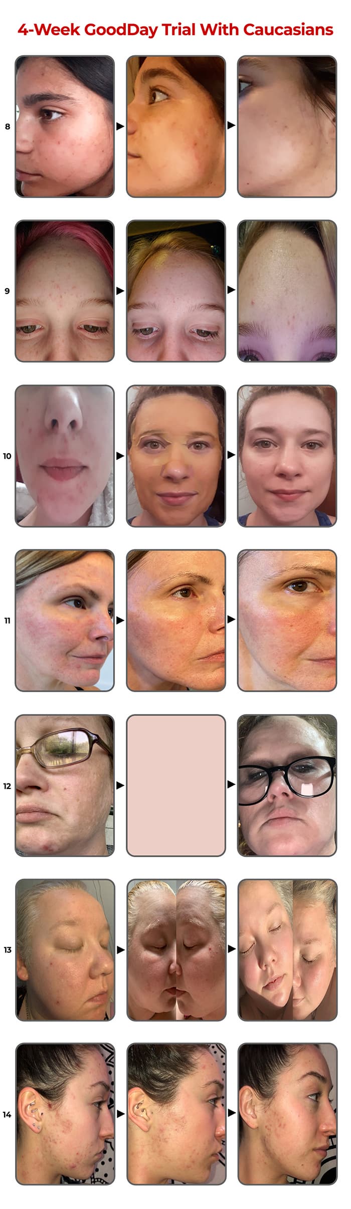 GoodDay Turmeric Mask, Whitening facial sheet, mask sheet, 