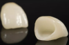 China Dental Lab | FDA Certified Dental Lab | MYY Service Lab