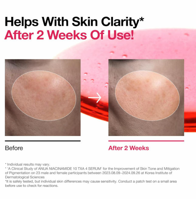 ANUA Niacinamide 10 + TXA 4 Serum