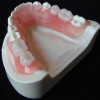 Zirconia Crown Zirconia Teeth Zirconia Denture